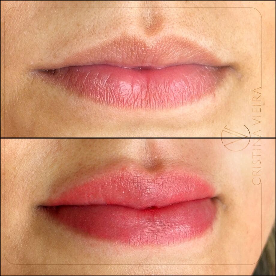 antes y despues micropigmentacion de labios